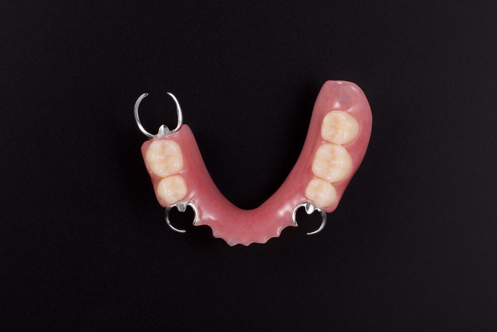 resindenture