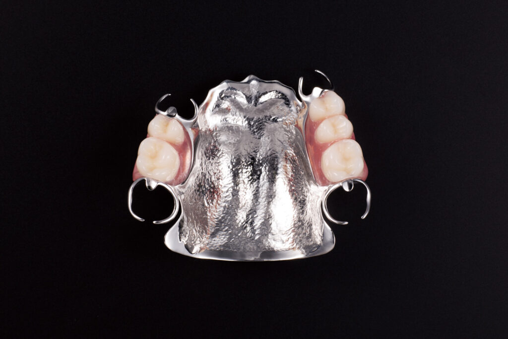 metaldenture